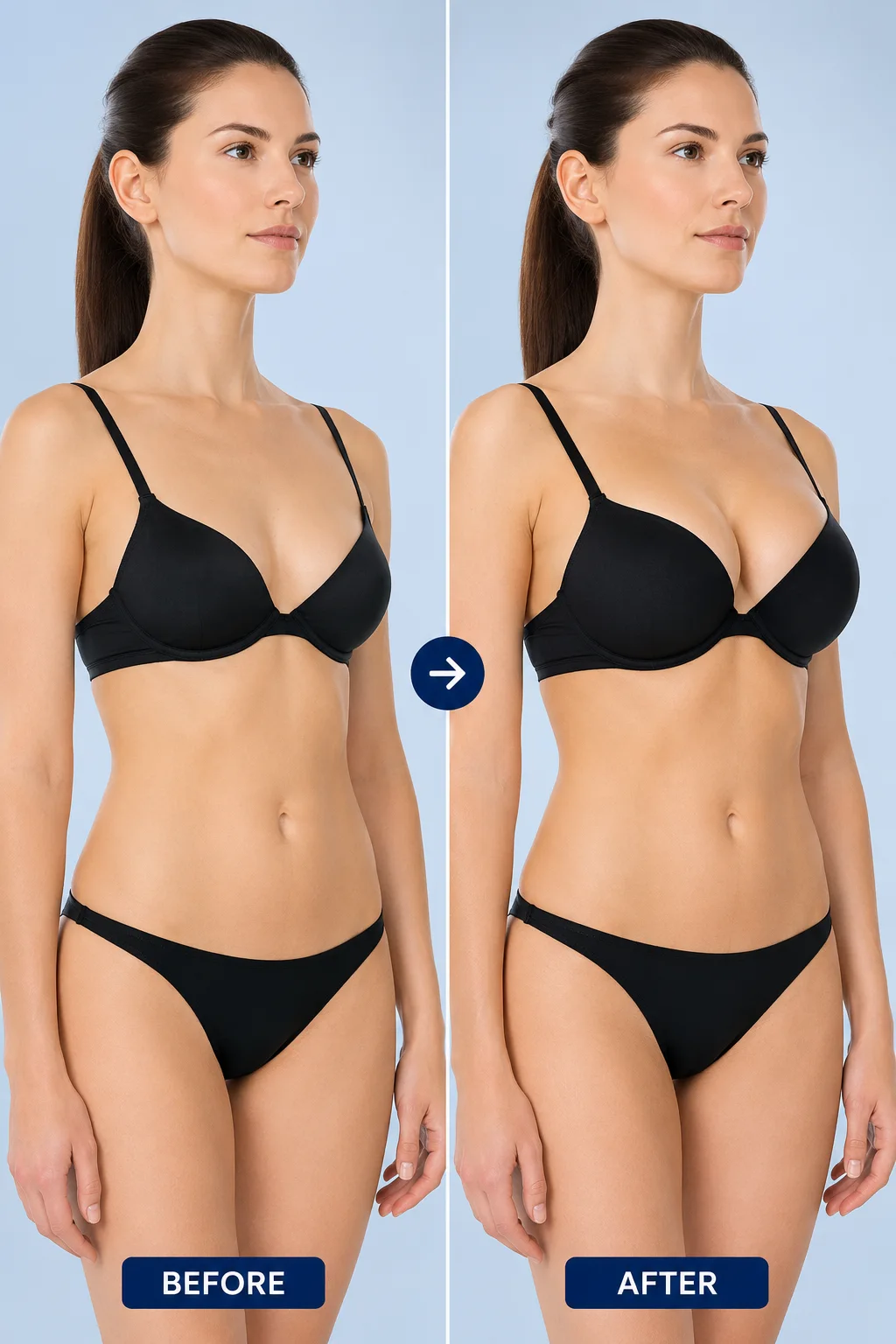 Before and after image breast lift procedure