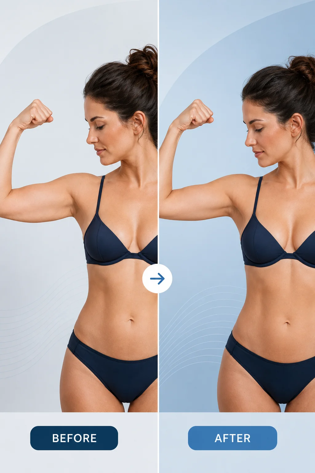 Brachioplasty before and after photos